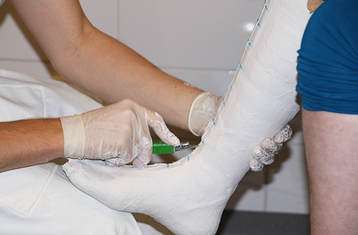 Onze specialisaties: prothesen en orthesen